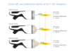 Imagem de INTELECT FOCAL SHOCKWAVE SET - CHATTANOOGA